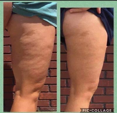 Dermatic Effects Firming Cream