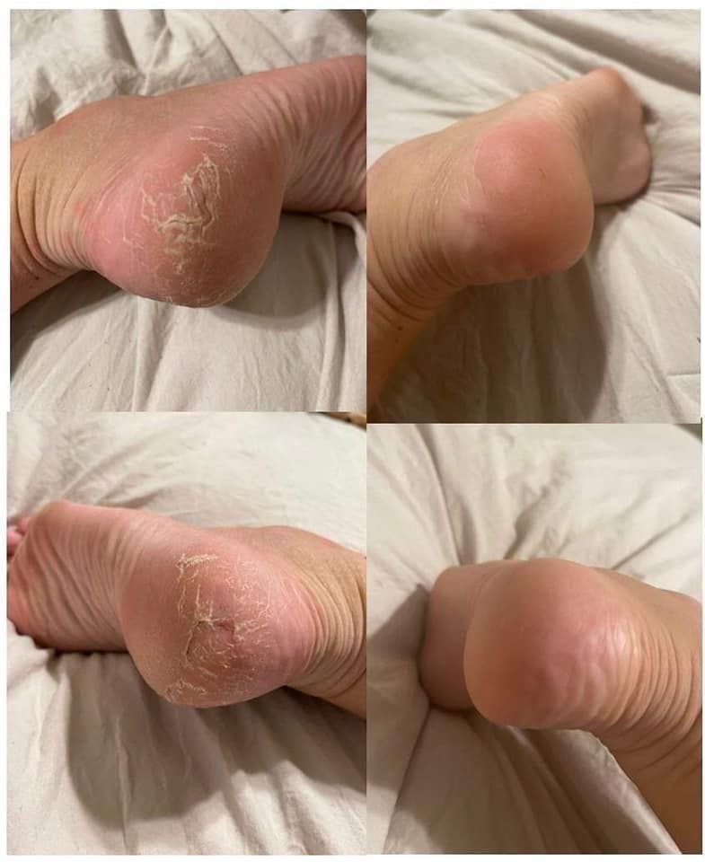 Sole Solution