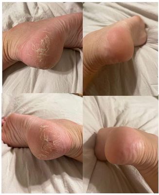 Sole Solution