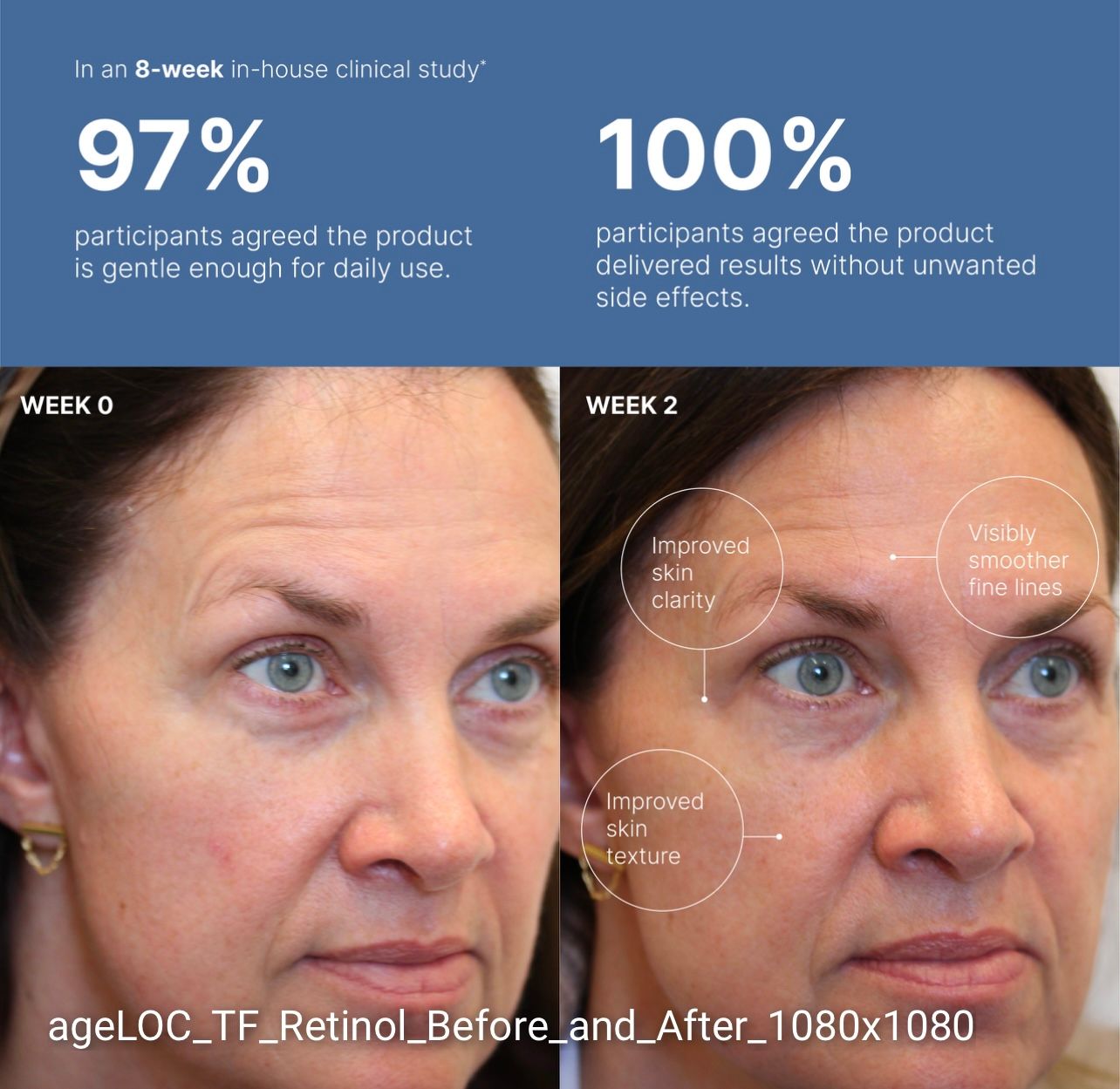 Retinol