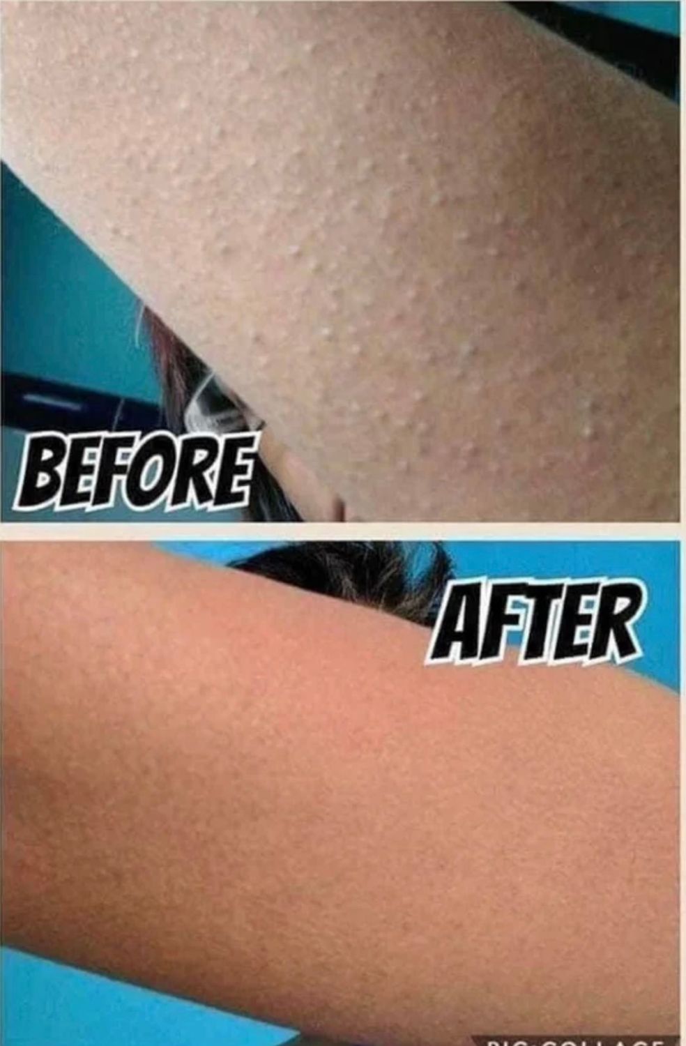 Polishing Bar
