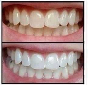 Whitening Toothpaste