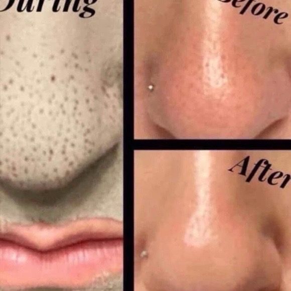 Marine Mud mask