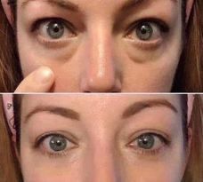 Ideal Eyes Eye Cream