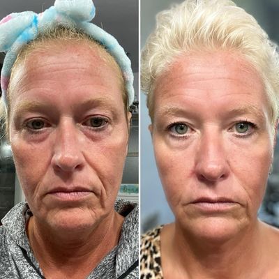 TFEU Serum Pearls (Botox In a bottle)