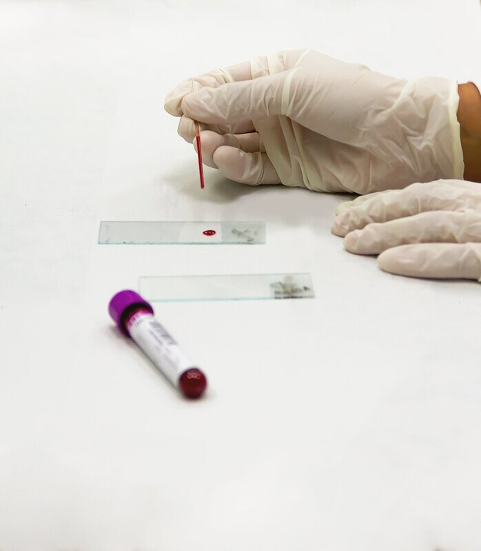 FULL BLOOD COUNT (FBC)