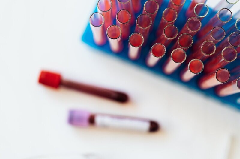 POLYCYSTIC OVARY SYNDROME (PCOS)