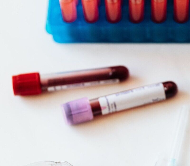 VITAMIN B12 (ACTIVE) TEST