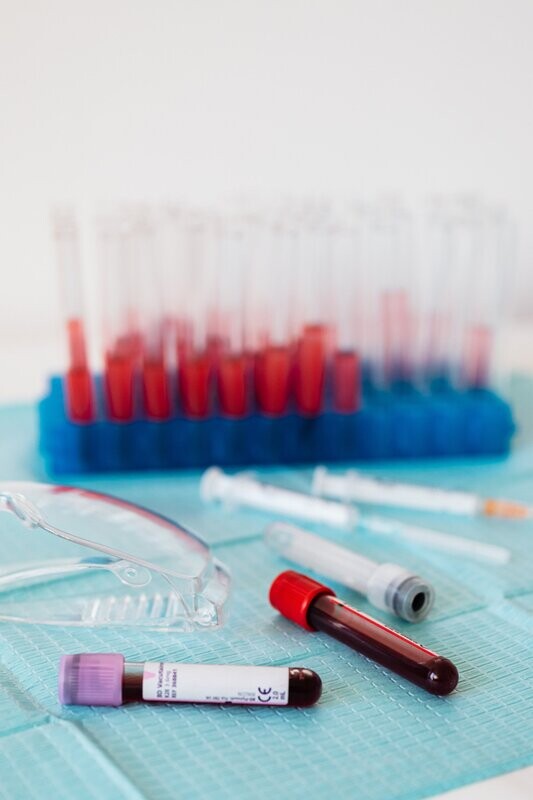 PROGESTERONE LEVELS