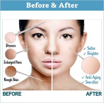 CURE Natural Aqua Gel Exfoliation