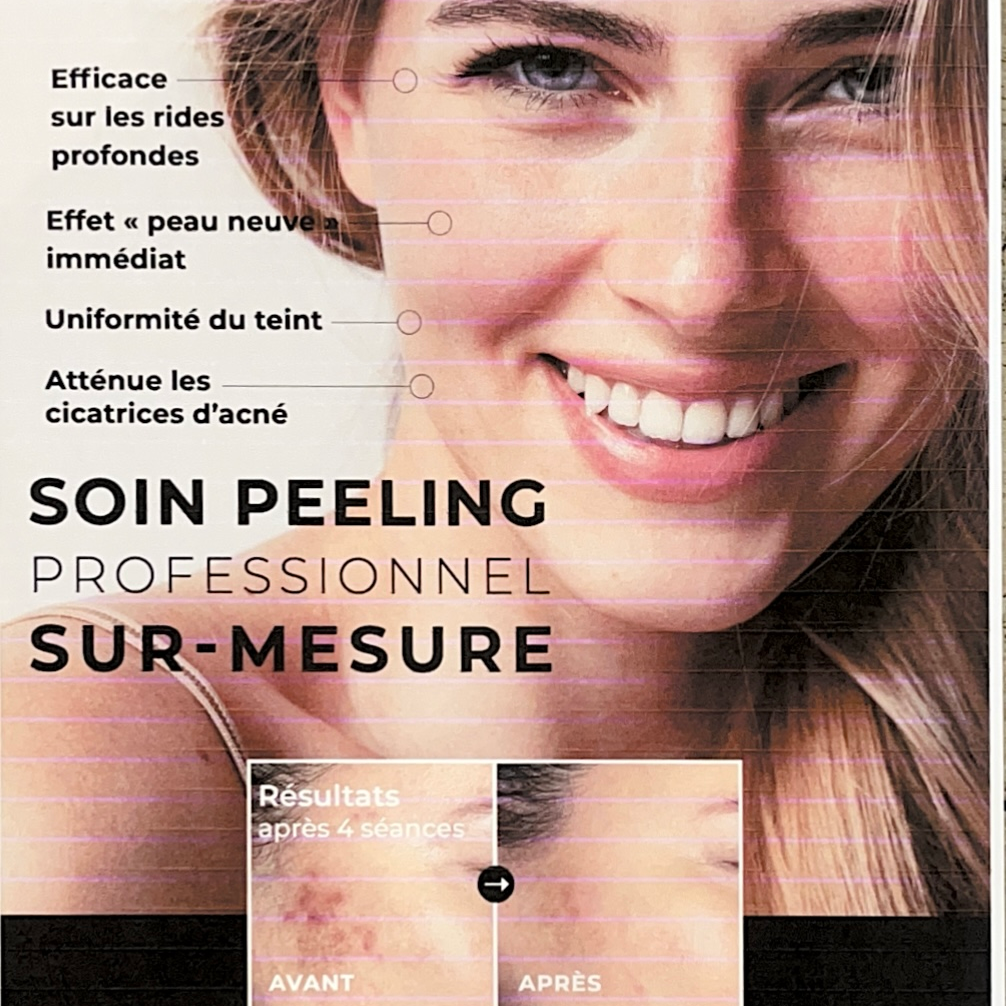 Cure Peeling visage