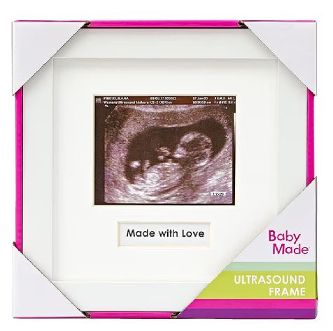 Ultrasound Frame