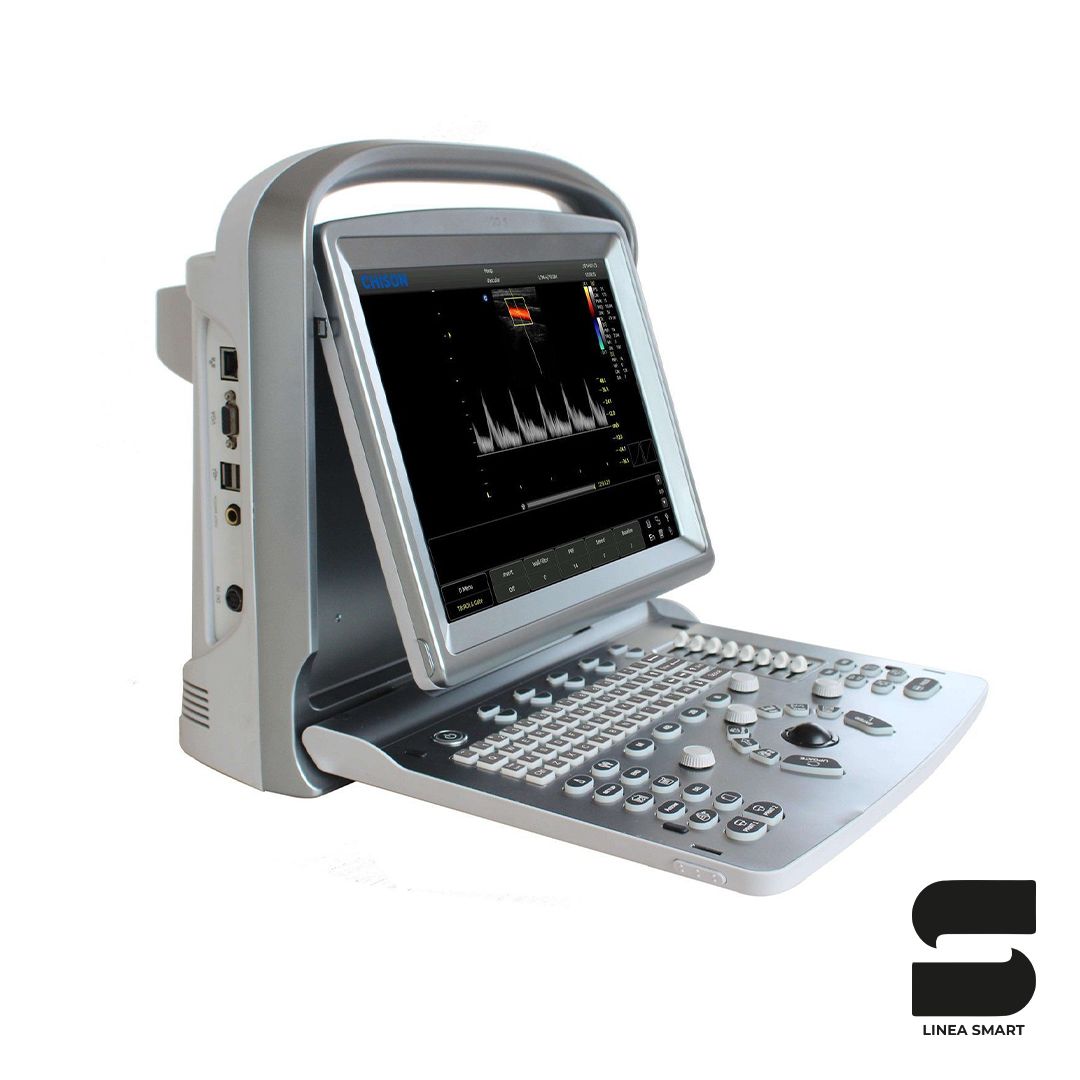 Colordoppler Chison ECO5