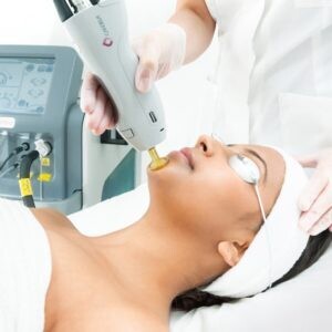3 Skin Tightening Treatments - now just $595