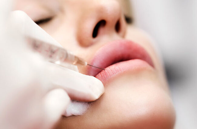 Beauty enhancement with Filler - $100 Off - now just $600
