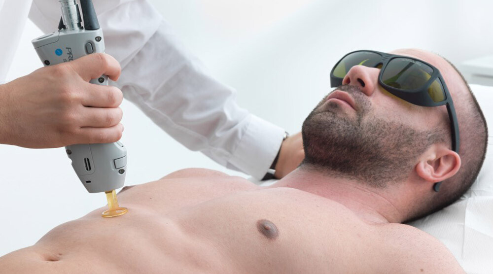 6 Treatments of Laser Hair Removal on an Extra Large Area - $1298