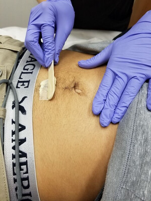 Stomach/Happy Trail