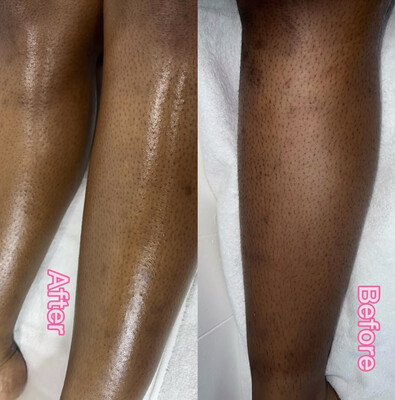 Full Leg