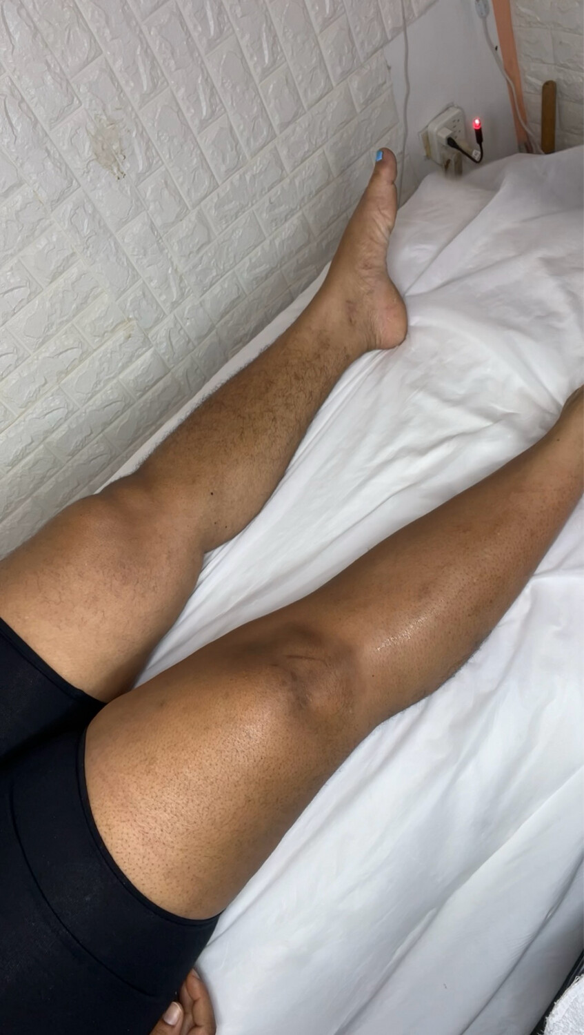 Half Leg
