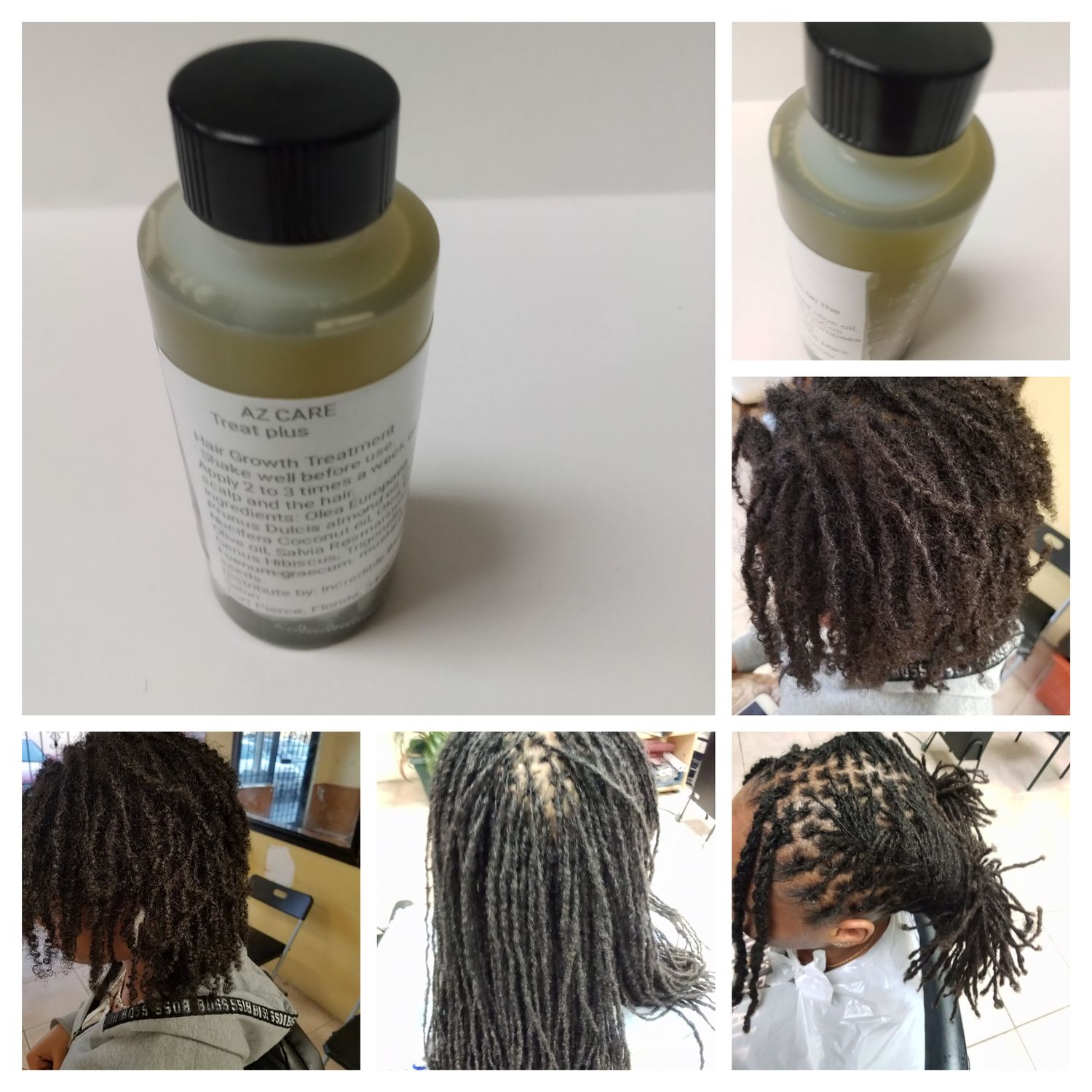 Hair growth