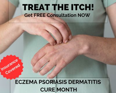 Eczema Cure Month!