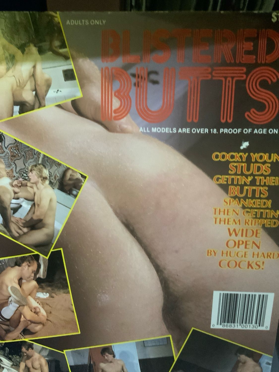 Blistered Butts