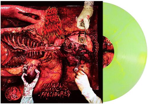 200 Stab Wounds "Manual Manic Procedures" (Yellow/Green Marble) - LP