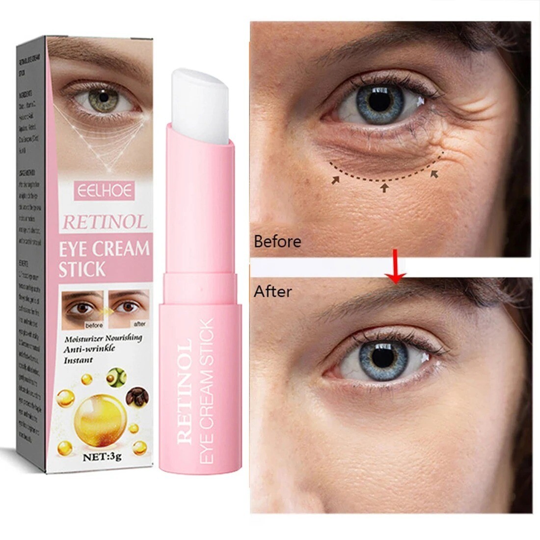 Retinol Eye Cream Instant Removing Eyes Wrinkle&amp; Dark&#39;s