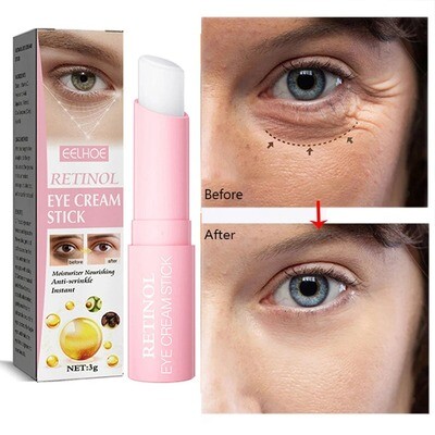 Retinol Eye Cream Instant Removing Eyes Wrinkle&amp; Dark&#39;s