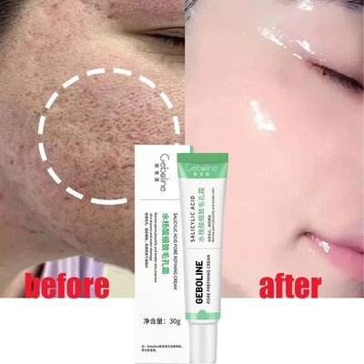Salicylic Acid Pore Shrinking Cream Quick Elimination Large Pores Remove