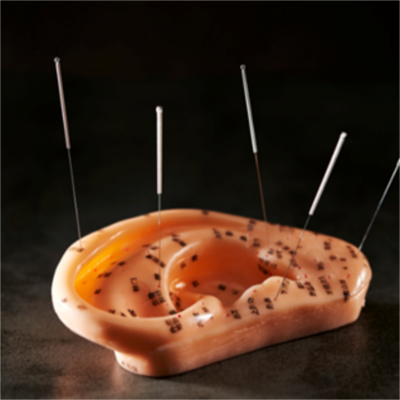 Auricular Acupuncture Sessions