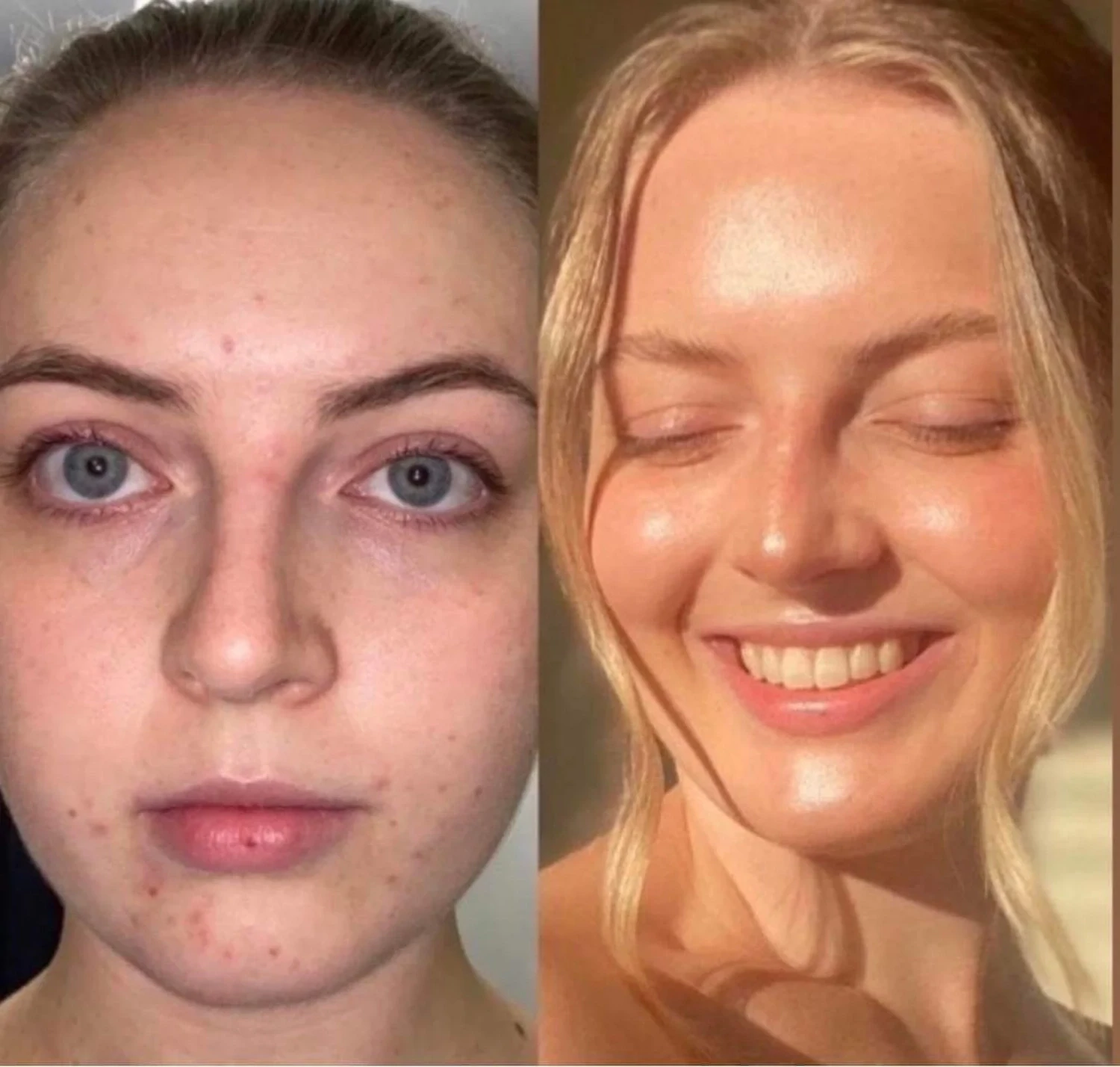 LumiSpa iO