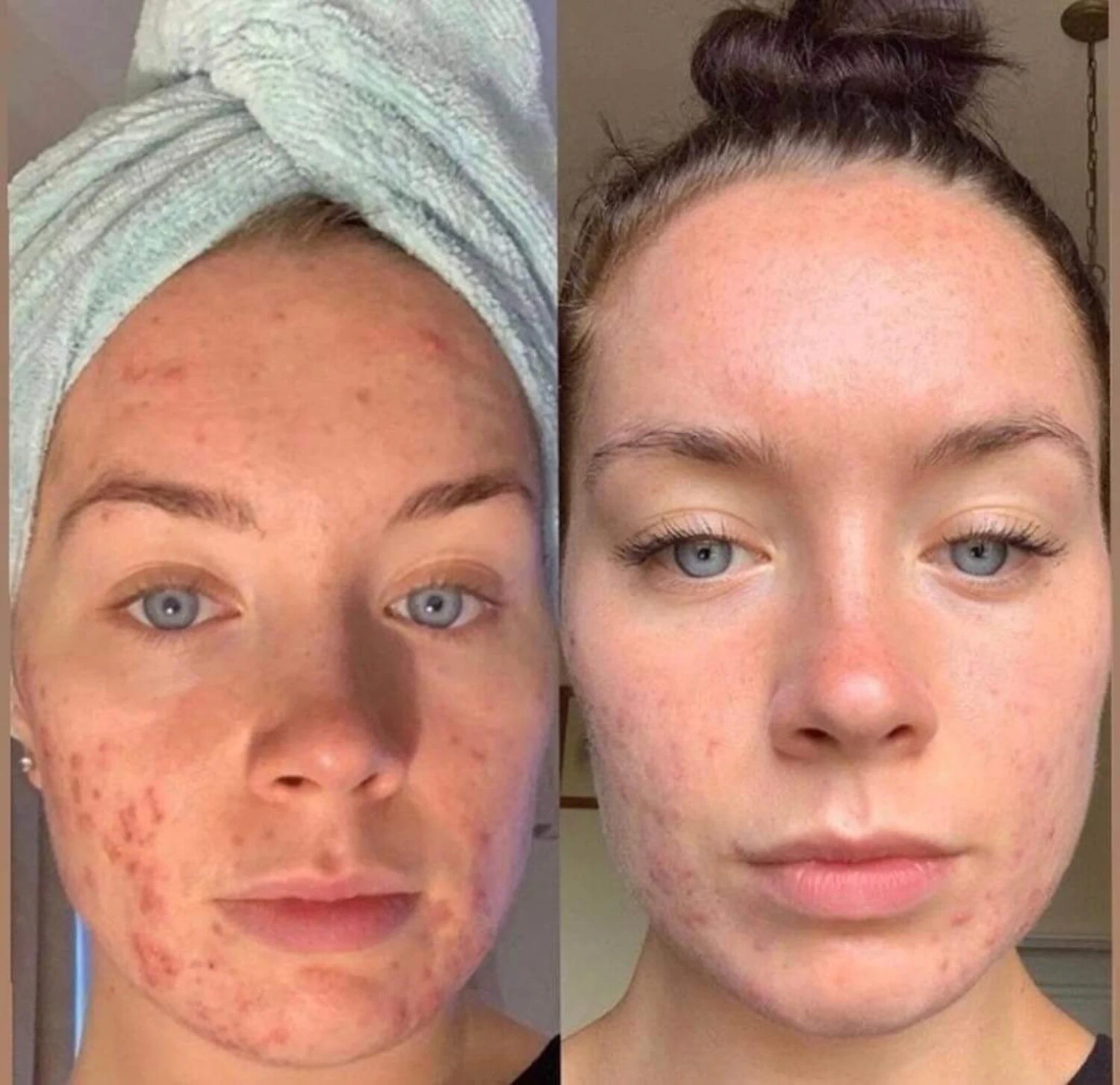 LumiSpa iO