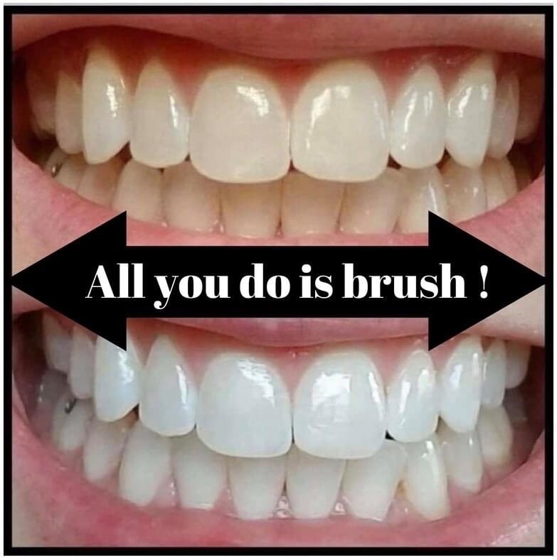 Whitening Toothpaste