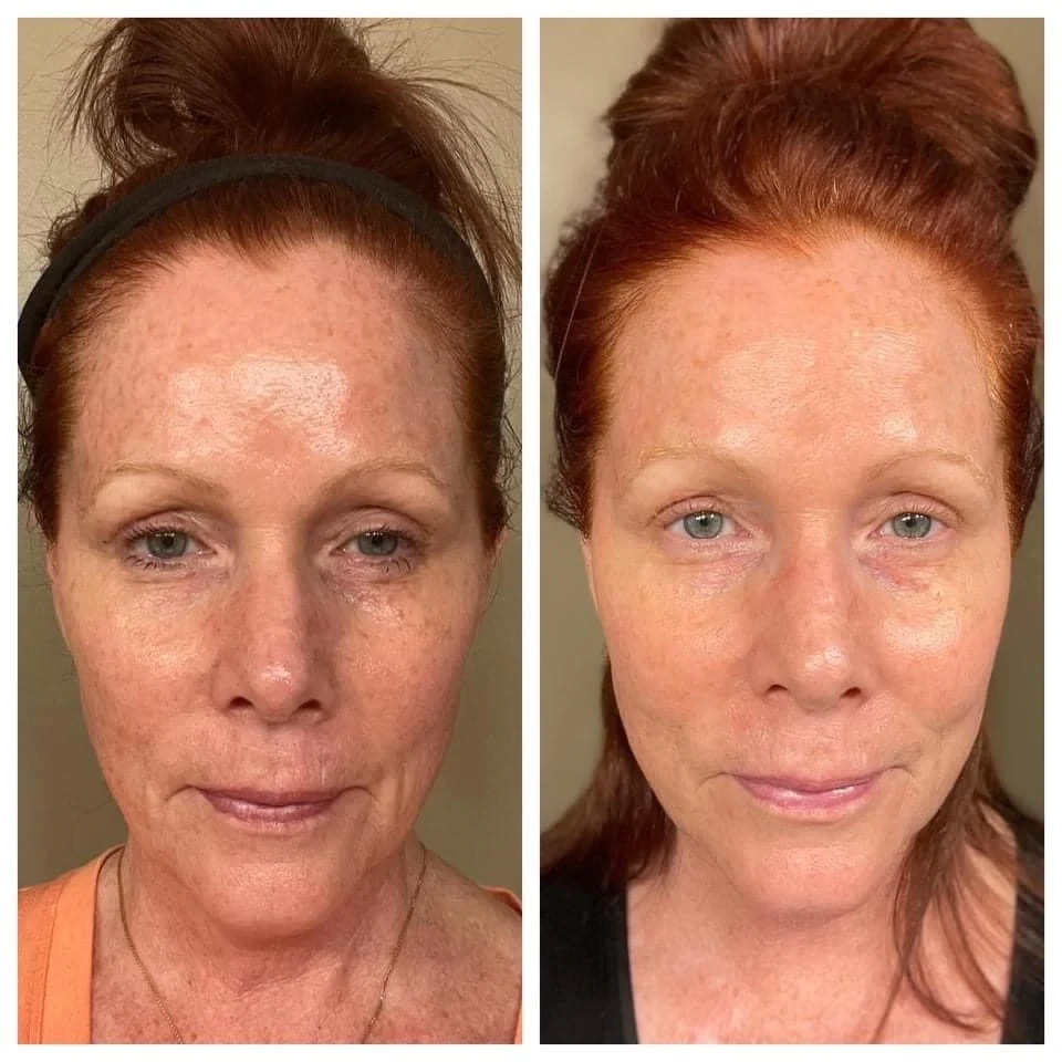 Collagen Plus - Peach Flavored