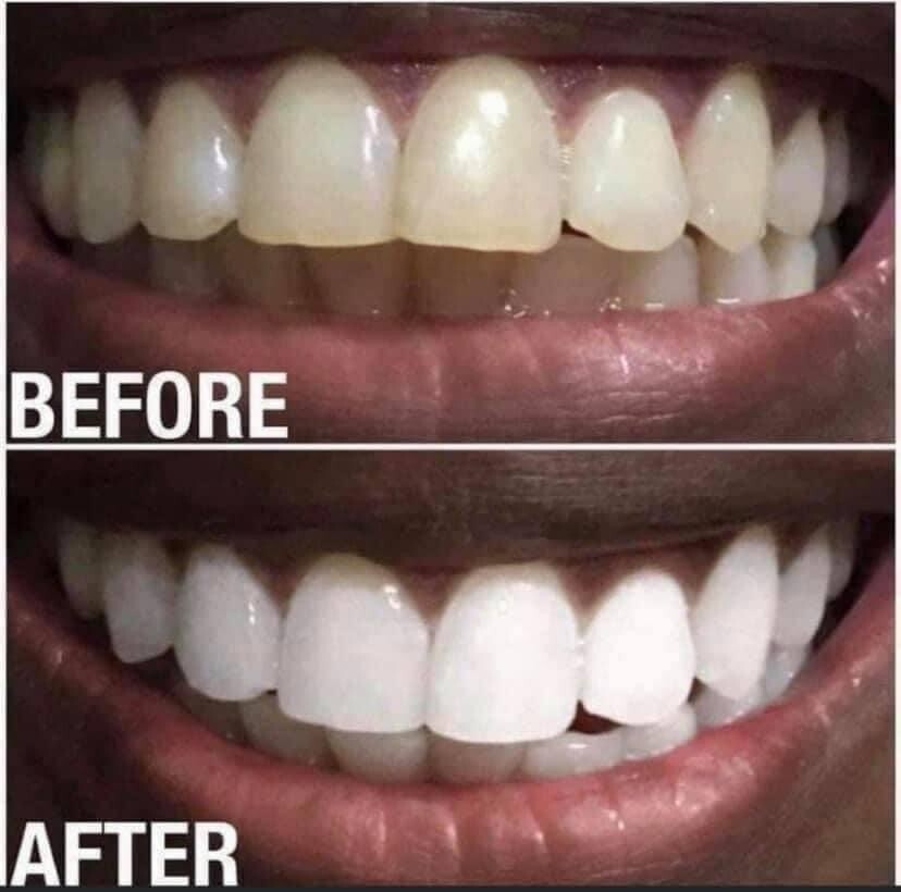 Whitening Toothpaste
