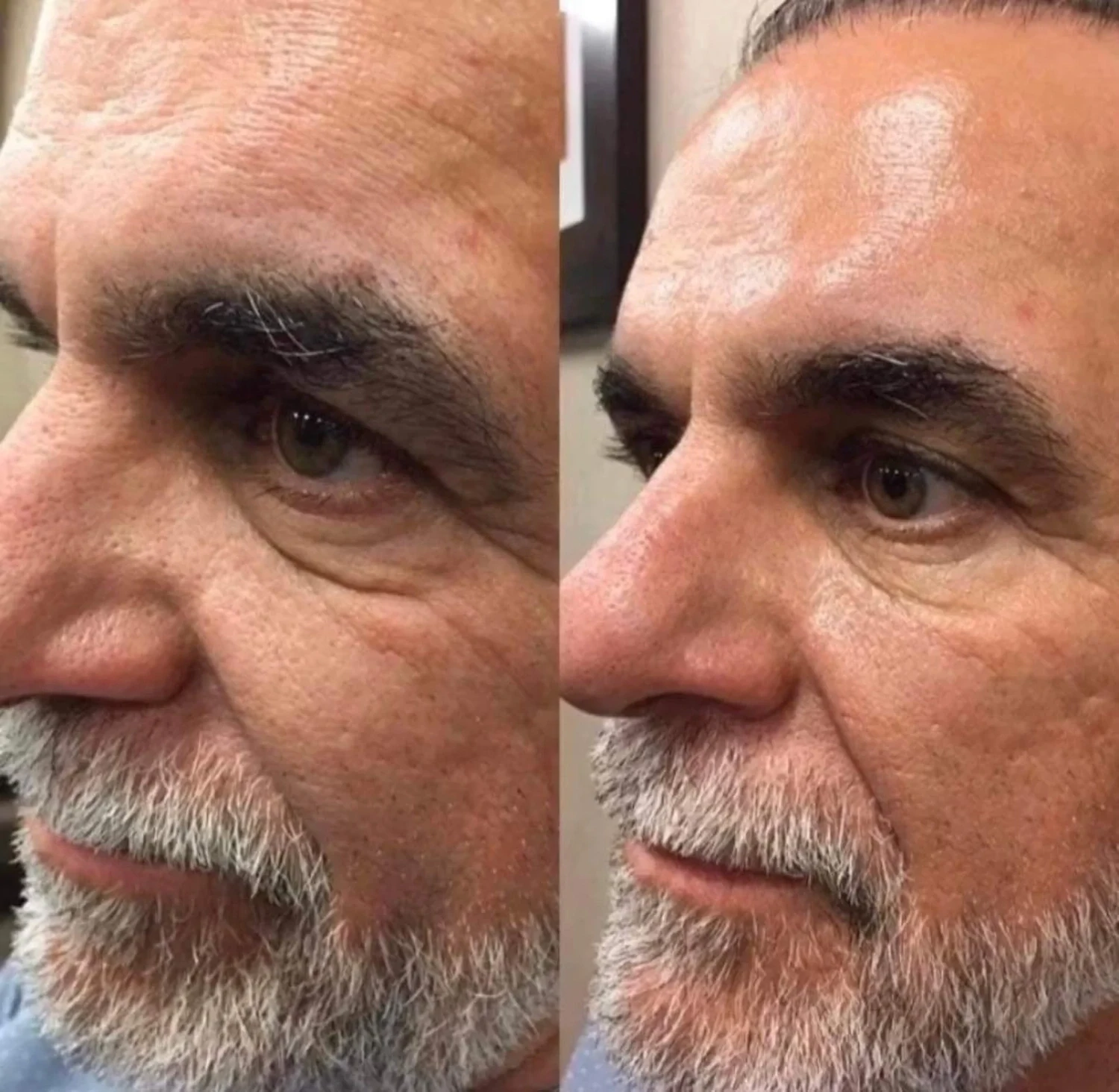 LumiSpa iO