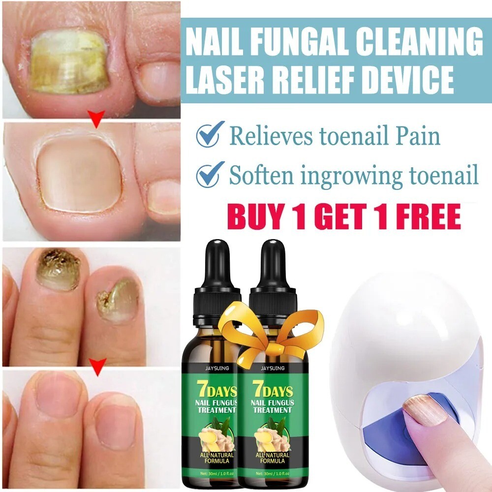 Nail Fungus Laser Treatment Device with 2 Nail Groove Relief Oil