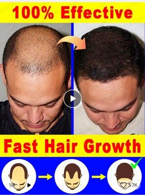 Men and Women Hair Growth Oil