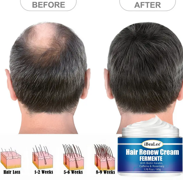 Anti Hair-loss Cream Hair Care Renewal Keratin Extracts