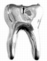 TOOTH PIN