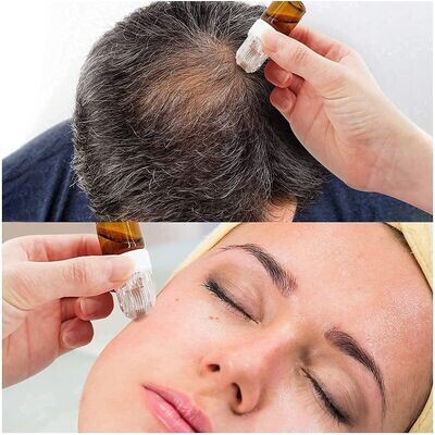 Medicina Estetica Rigenerativa con Esosomi per ACNE-Calvize-Antirughe