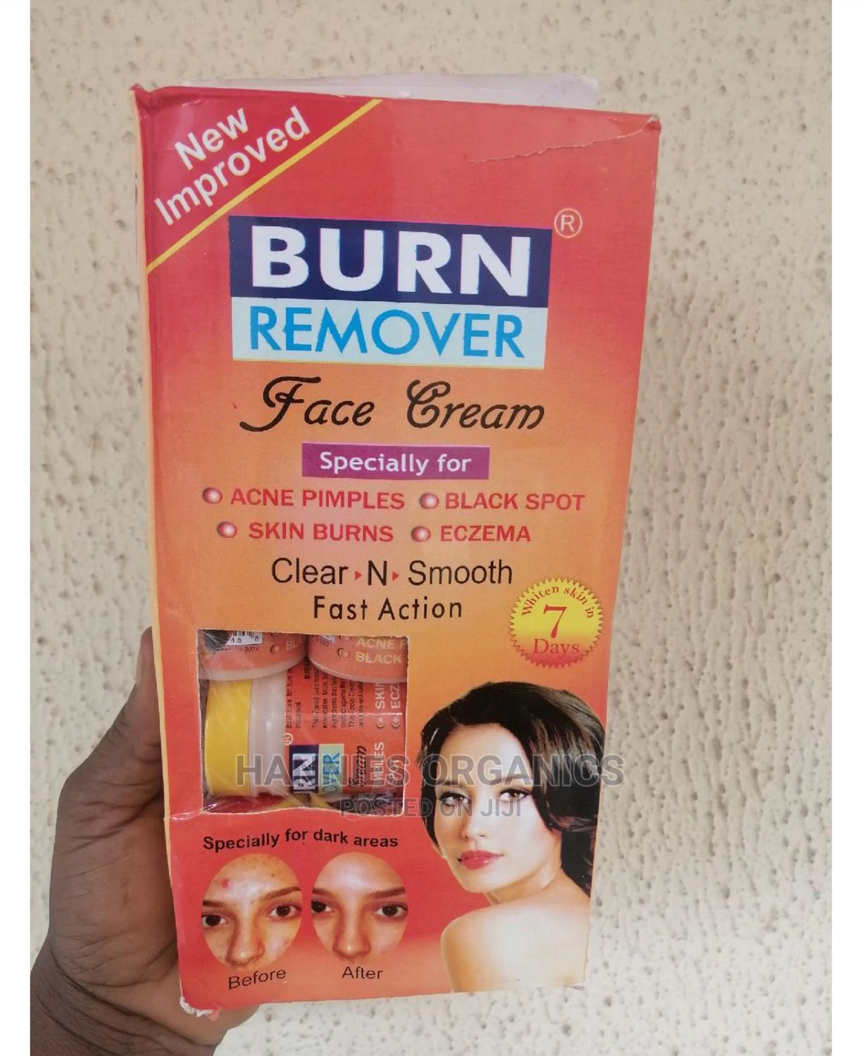Burn Remover Face Cream (one Pcs