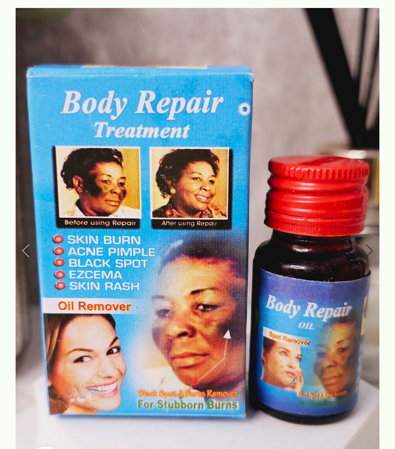 Body Repair Oil For Sunburn