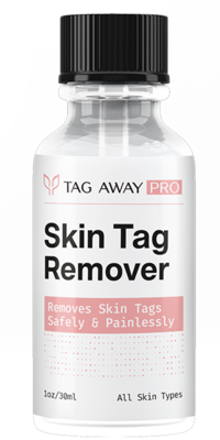 Tag Away Pro Skin Tag Remover
