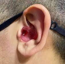 Ear Plugs / Nose Plugs