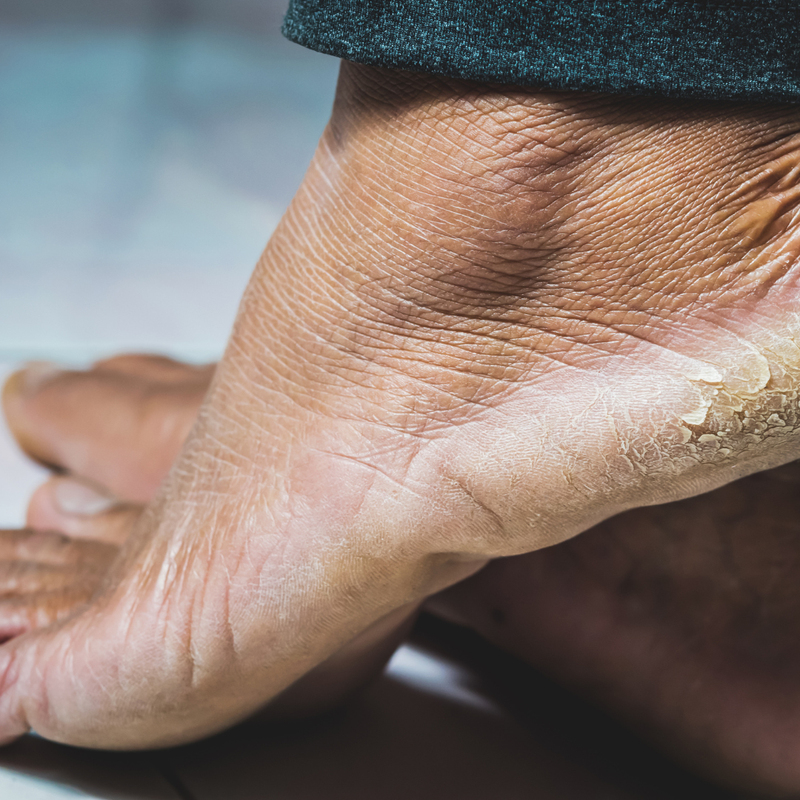 Pedicure rasp