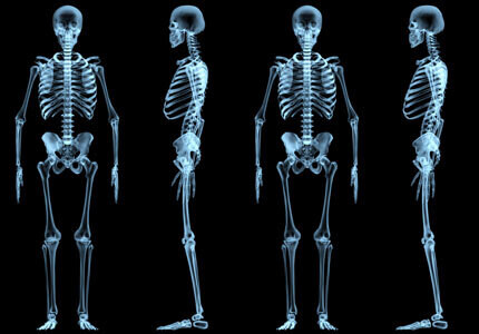 Bone & Brain Health - Queen Concerns