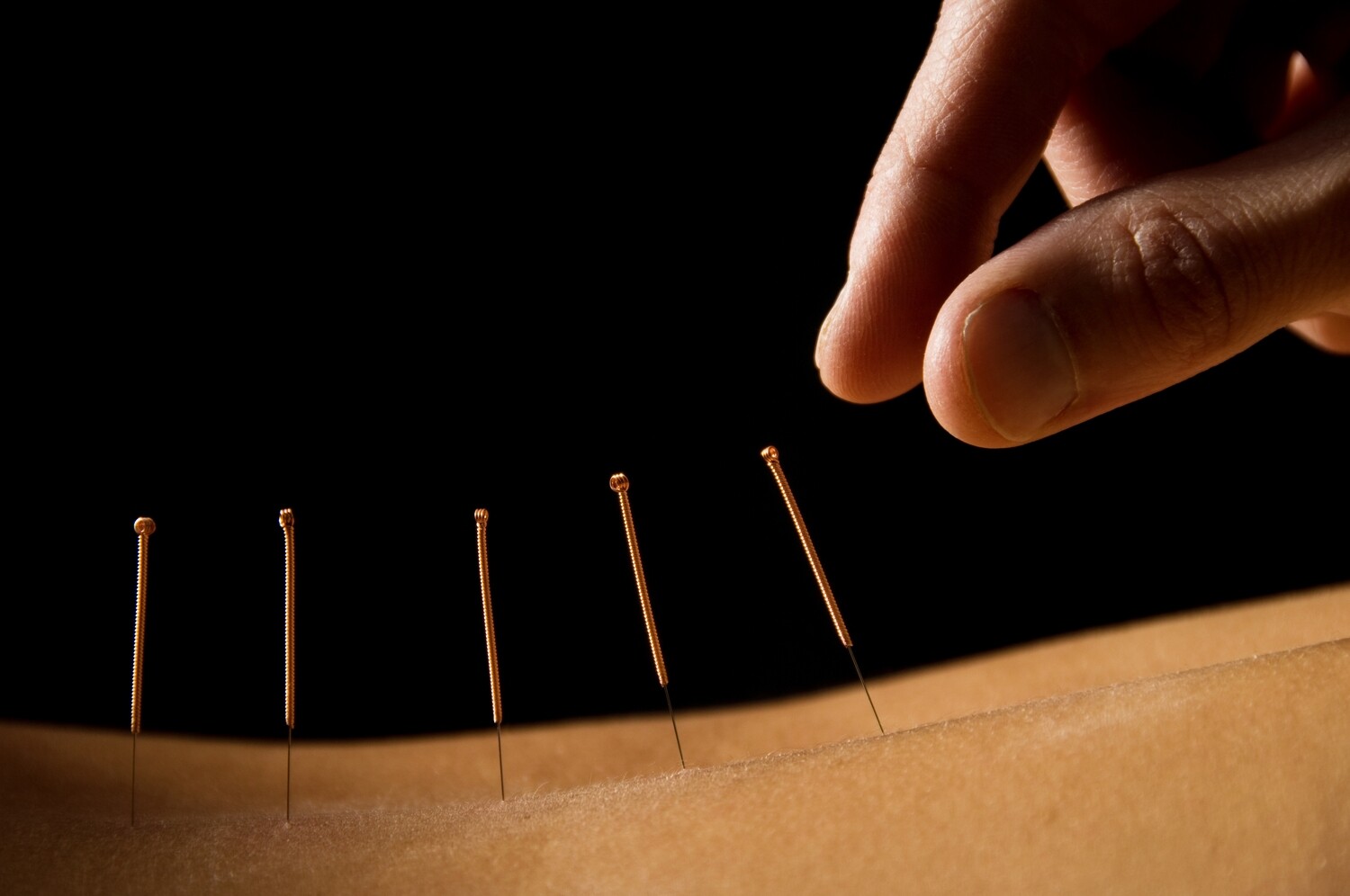 L&#39;ACUPUNCTURE ETHÉRIQUE
