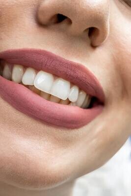 Les soins des dents